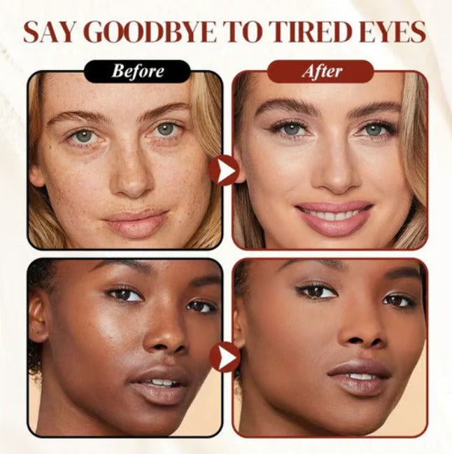 ✨ LAST DAY PROMOTION - BUY 1 GET 1 FREE✨Colored Clay Undereye Corrector